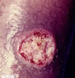 CUTANEOUS PARASITIC INFECTIONS