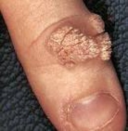 CUTANEOUS VIRAL INFECTIONS