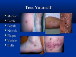 DERMATOLOGIC DIAGNOSIS