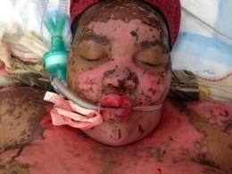 DERMATOLOGIC EMERGENCIES
