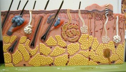 SWEAT GLAND DISORDERS