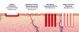 FRACTIONAL LASER