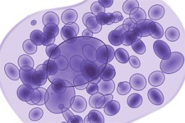 MASTOCYTOSES AND HISTIOCYTOSES