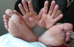 THE HANDS AND FEET